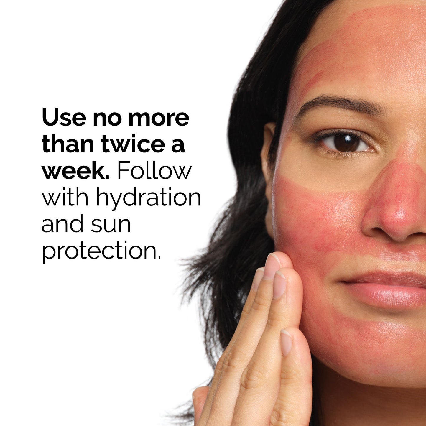 The Ordinary AHA 30% + BHA 2% Peeling Solution (30ml)
